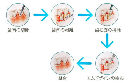 エムドゲインとは