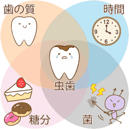 むし歯４つの要因